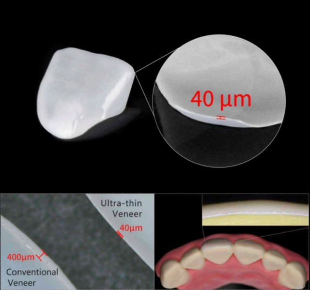 全球最薄3D打印牙科贴面获批立项国家“十四五”重点研发计划